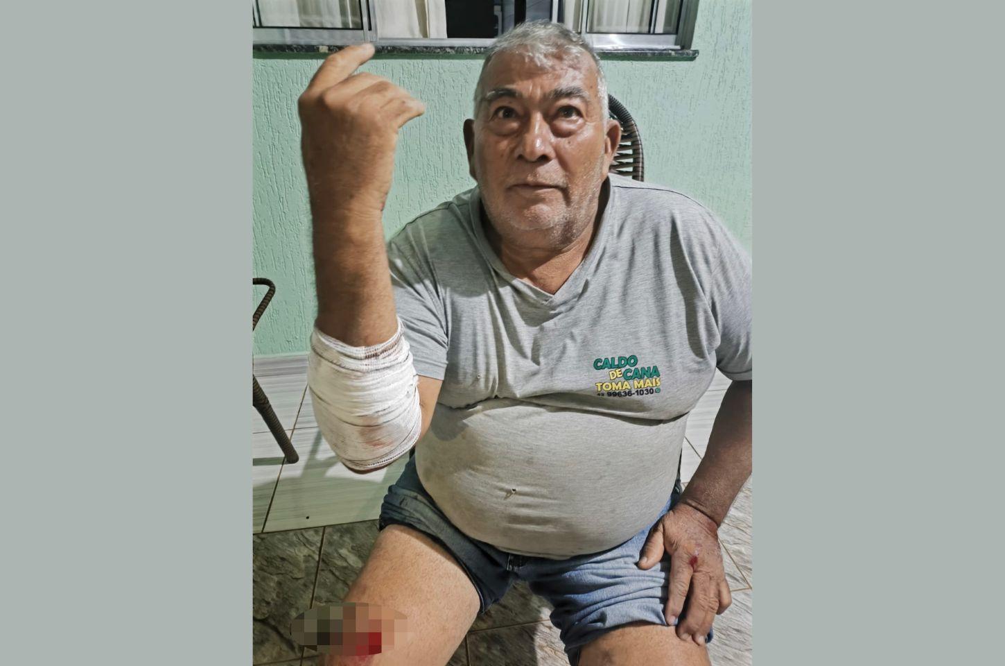Filha de morador de Jardim Alegre se preocupa com a situação após pai ser atacado por cachorro na rua