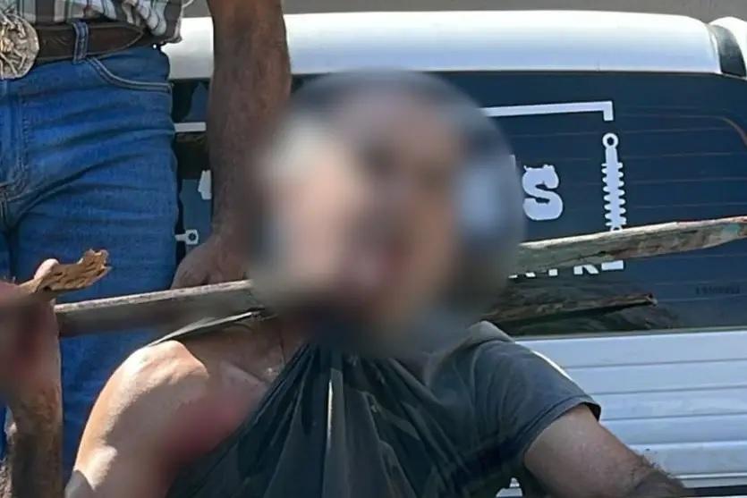 Morador de Xambrê anda 500 metros com estaca atravessada no pescoço e sobrevive após cirurgia