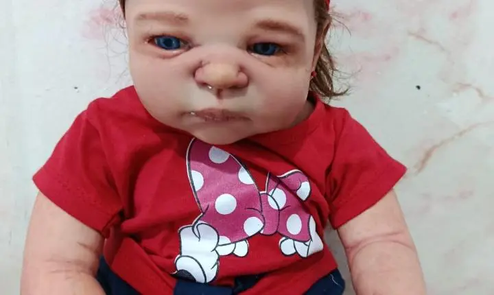 Artesã de Jardim Alegre realiza sorteio beneficente de bebê reborn para ajudar sobrinha de 9 anos internada com púrpura em Curitiba; entenda a doença